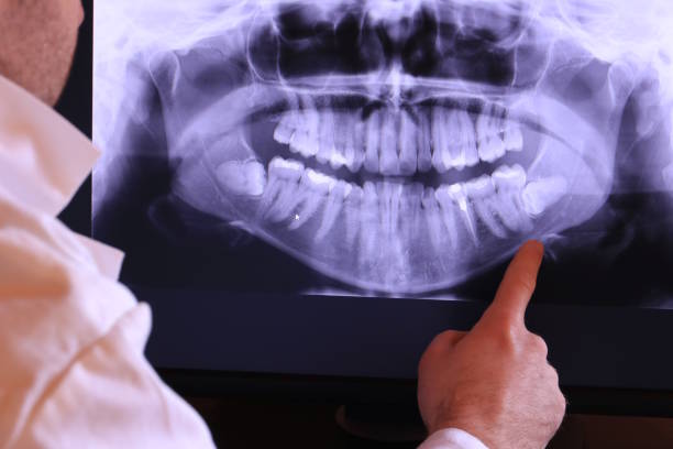 Best Urgent Dental Care for Toothaches in St Francis, KS