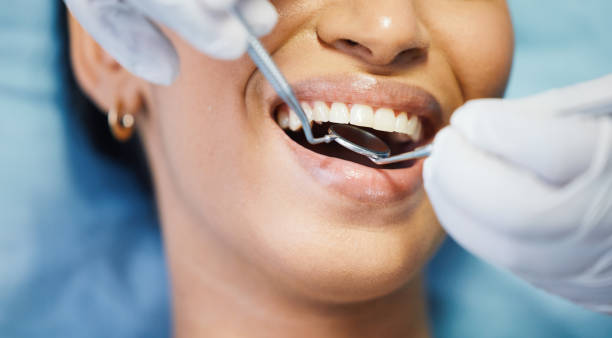 Best Dental Abscess Treatment in St Francis, KS