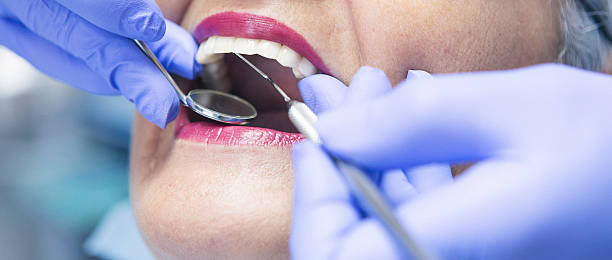 Best Knocked-Out Tooth (Avulsed Tooth) Treatment in St Francis, KS